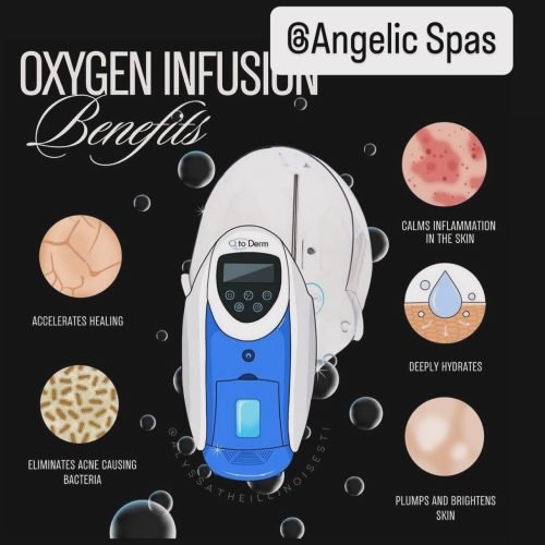 oxgen facial Northridge